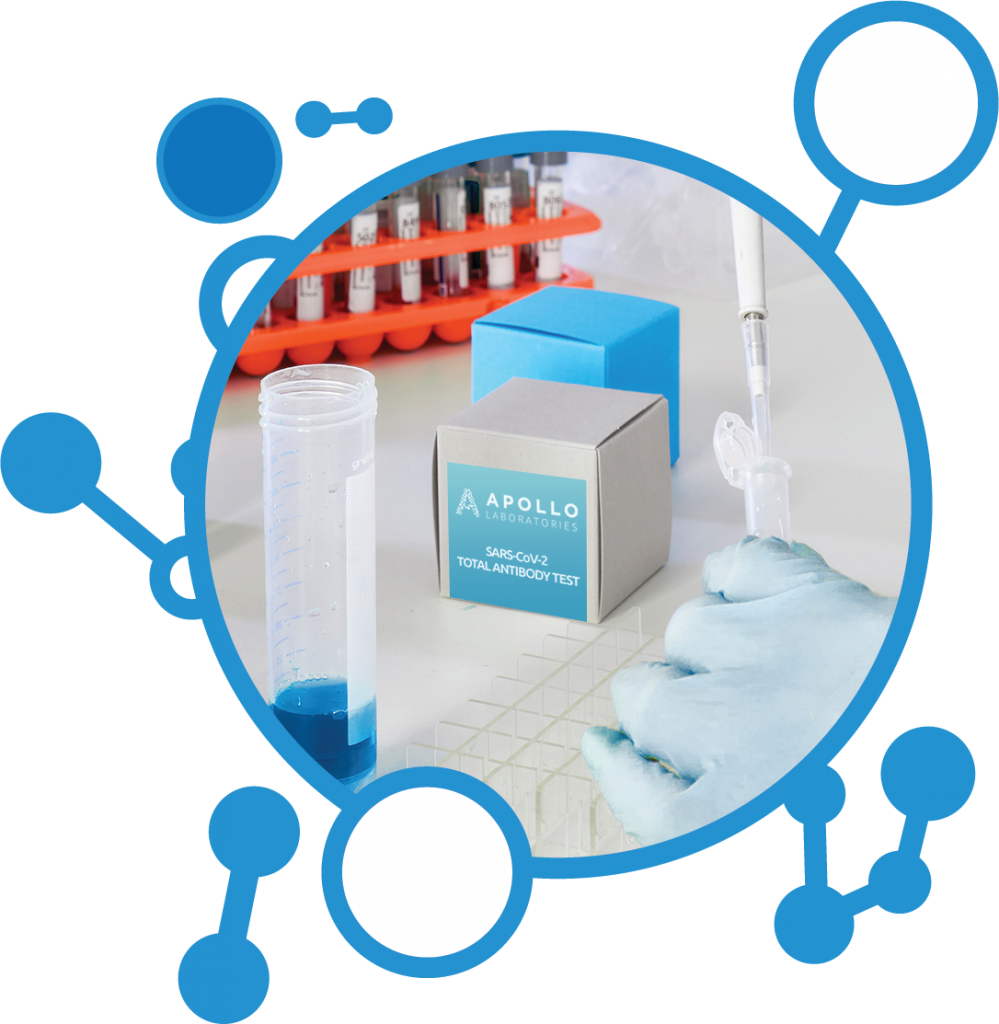 COVID-19 antibody test